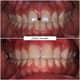 Slider image (7) FMS Dental Hospital - Kukatpally